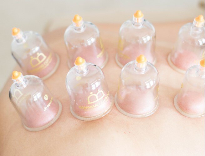 Cupping 